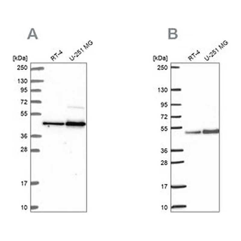 Merck Anti-ARFGAP1 antibody produced in rabbit