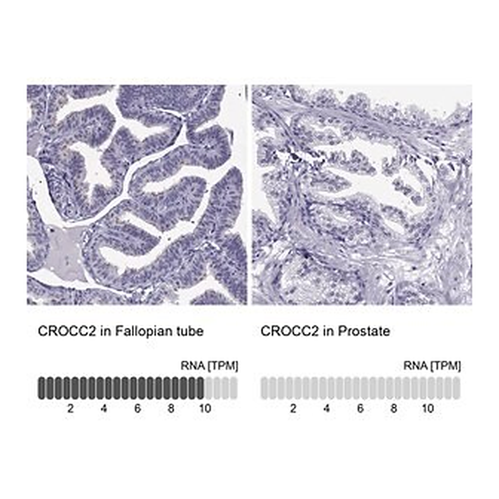 Merck Anti-CROCC2 antibody produced in rabbit