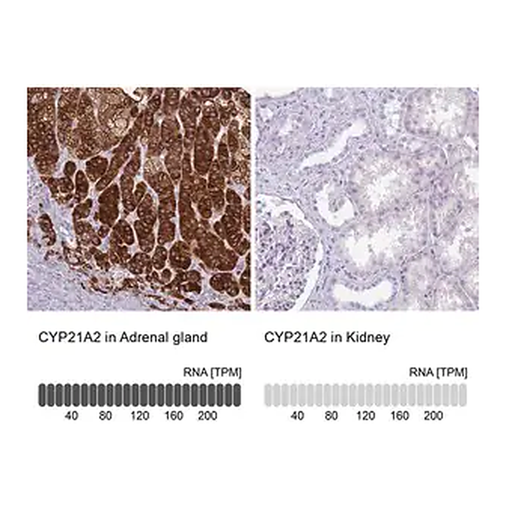 Merck Anti-CYP21A2 antibody produced in rabbit
