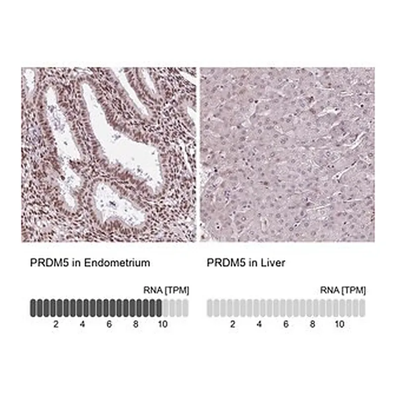 Merck Anti-PRDM5 antibody produced in rabbit