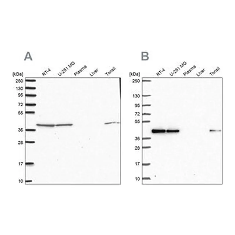 Merck Anti-IDH3B antibody produced in rabbit