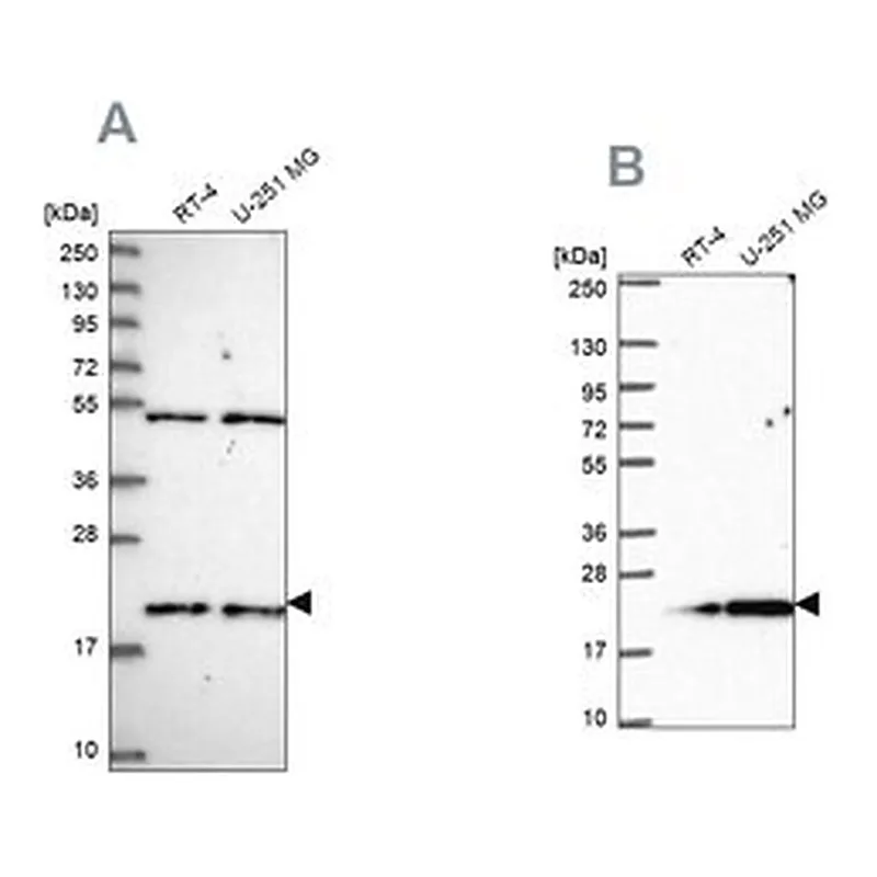 Merck Anti-KIAA1143 antibody produced in rabbit