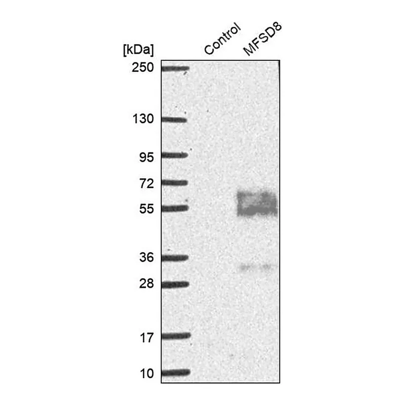 Merck Anti-MFSD8 antibody produced in rabbit