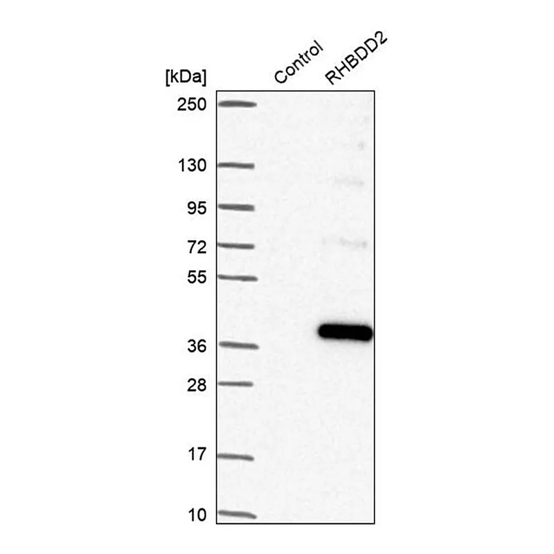 Merck Anti-RHBDD2 antibody produced in rabbit
