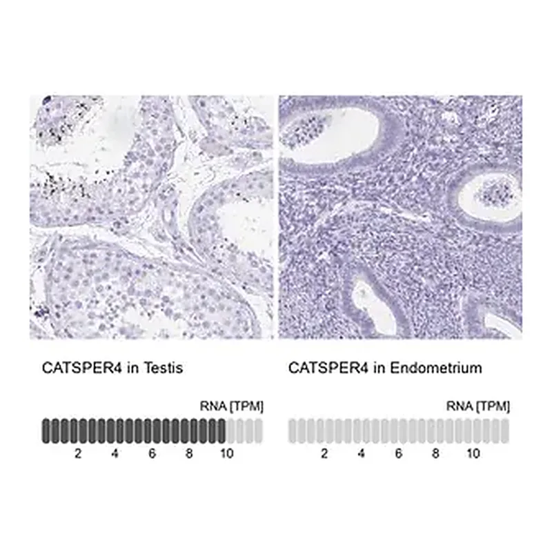 Merck Anti-CATSPER4 antibody produced in rabbit