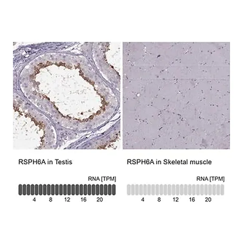 Merck Anti-RSPH6A antibody produced in rabbit