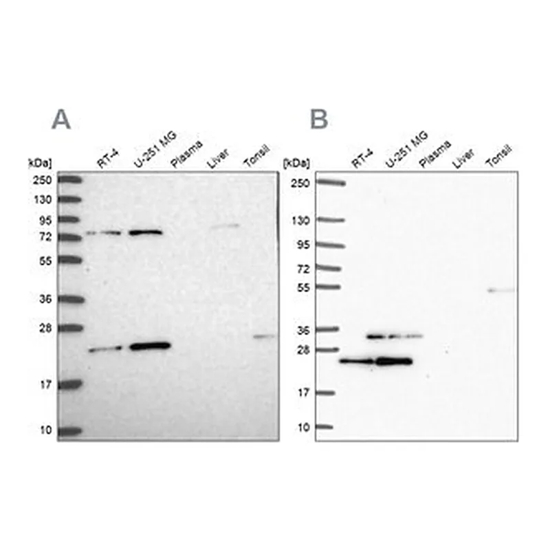 Merck Anti-EIF3K antibody produced in rabbit