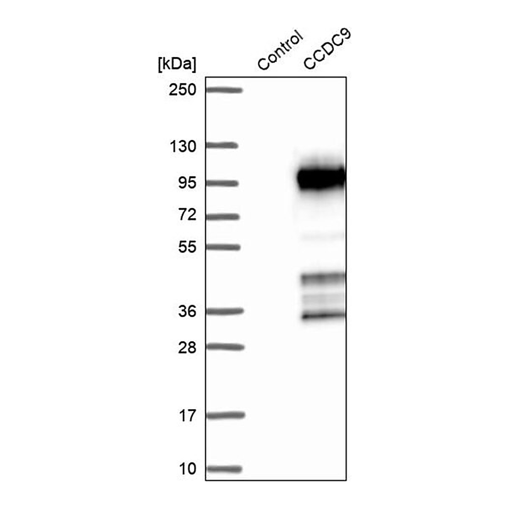 Merck Anti-CCDC9 antibody produced in rabbit