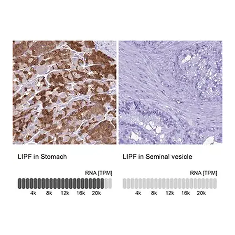 Merck Anti-LIPF antibody produced in rabbit