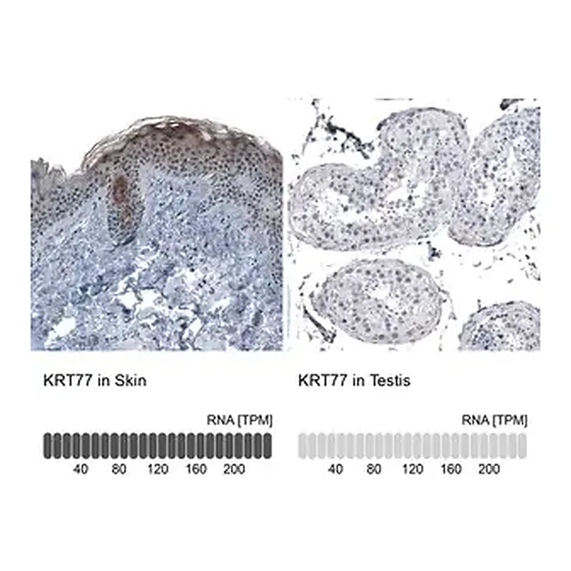 Merck Anti-KRT77 antibody produced in rabbit