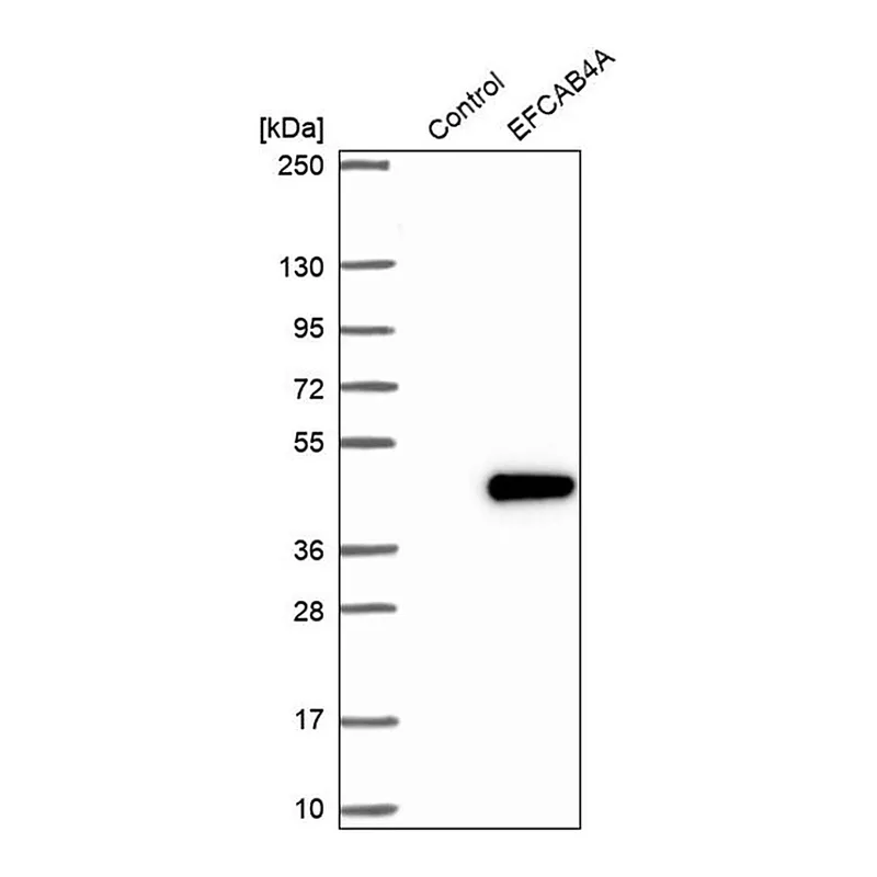 Merck Anti-CRACR2B antibody produced in rabbit