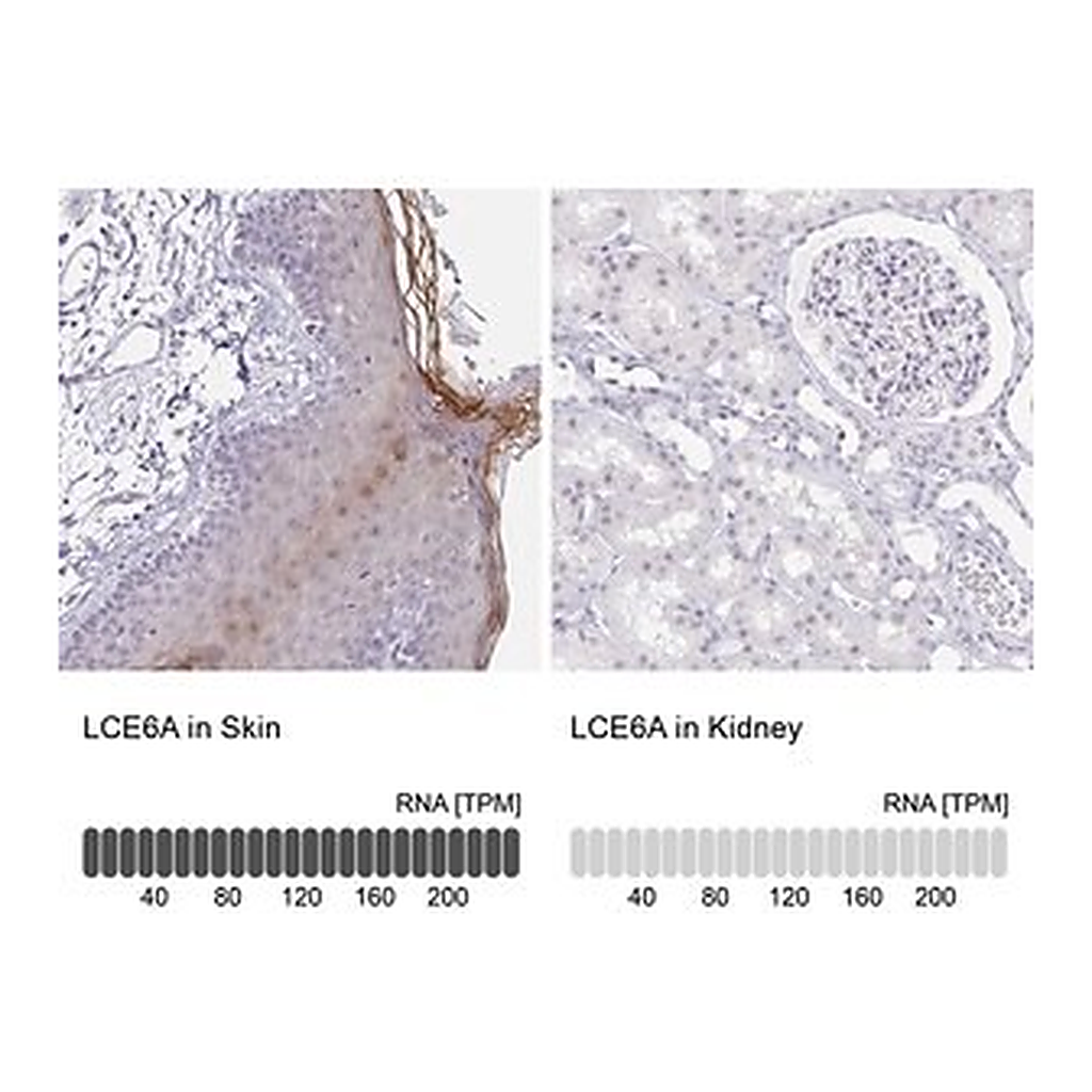 Merck Anti-LCE6A antibody produced in rabbit