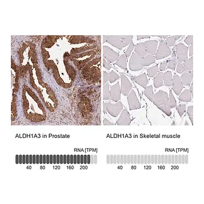 Merck Anti-ALDH1A3 antibody produced in rabbit