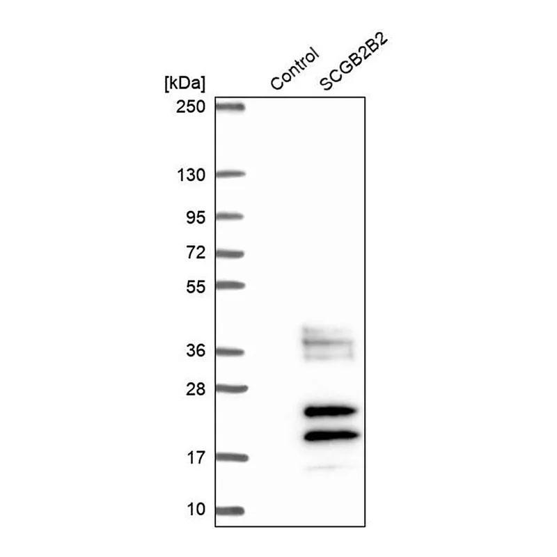 Merck Anti-SCGB2B2 antibody produced in rabbit