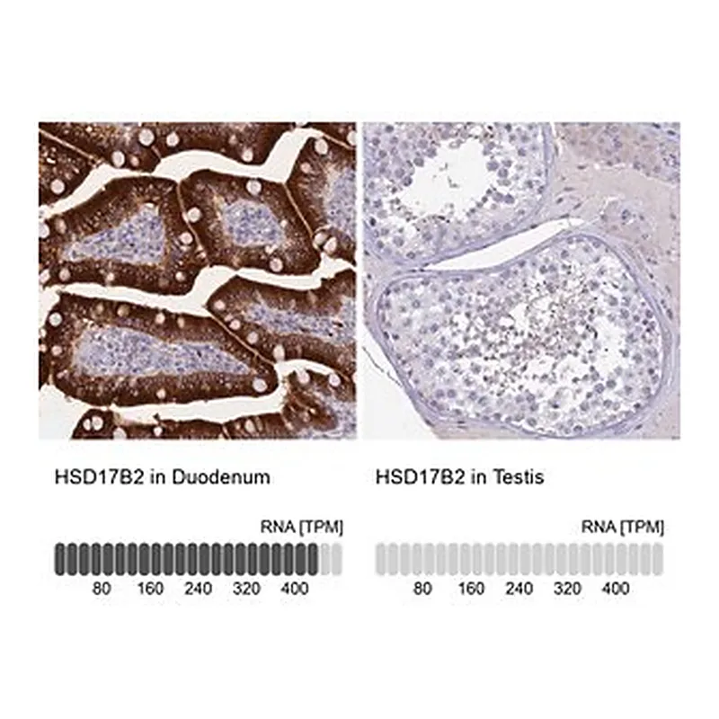 Merck Anti-HSD17B2 antibody produced in rabbit