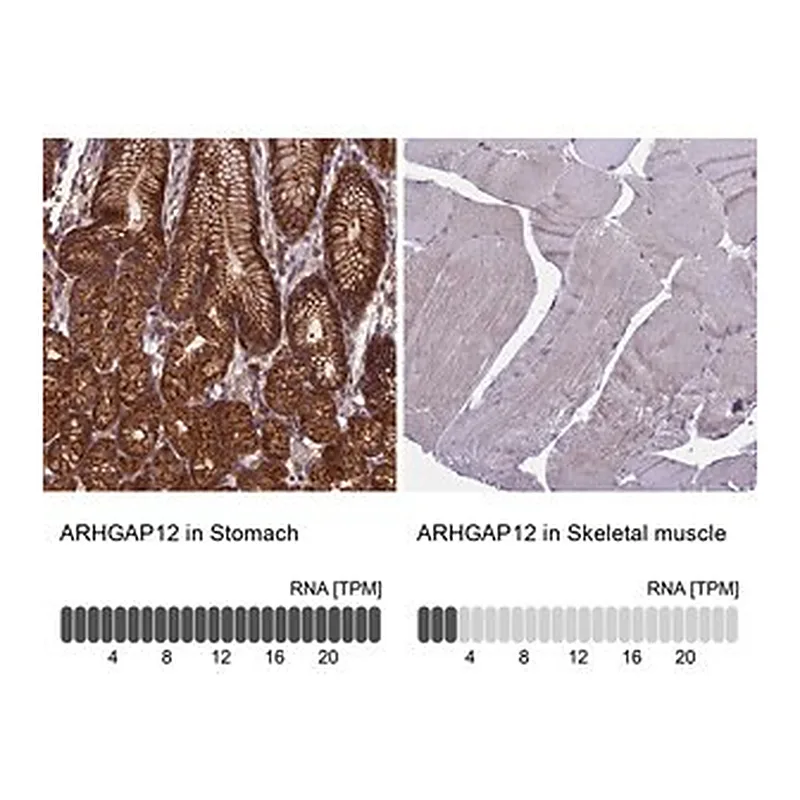 Merck Anti-ARHGAP12 antibody produced in rabbit