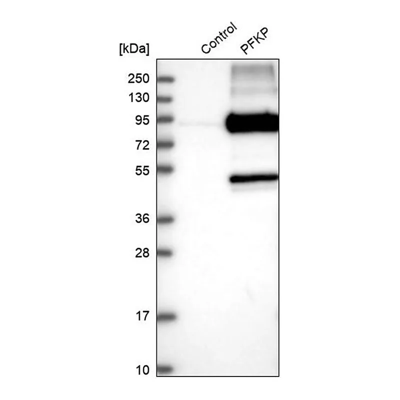 Merck Anti-PFKP antibody produced in rabbit