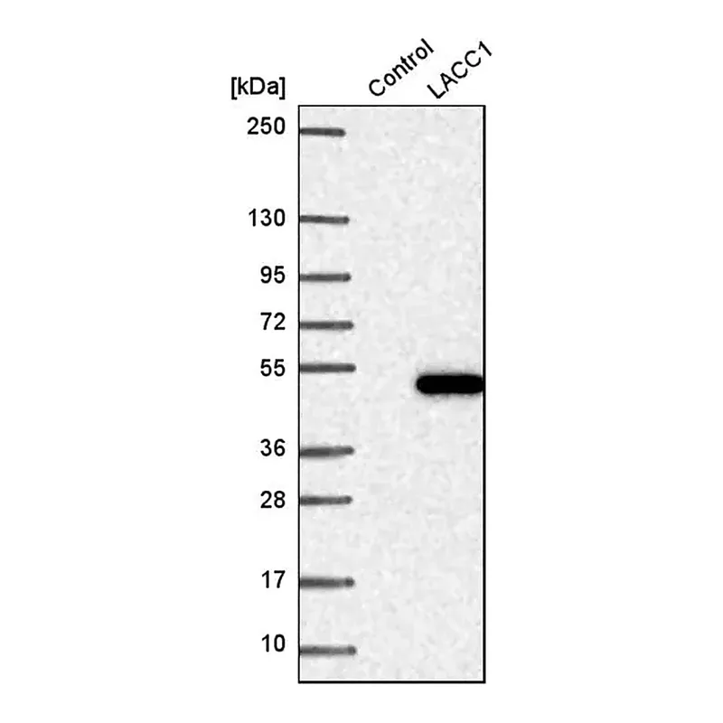 Merck Anti-LACC1 antibody produced in rabbit