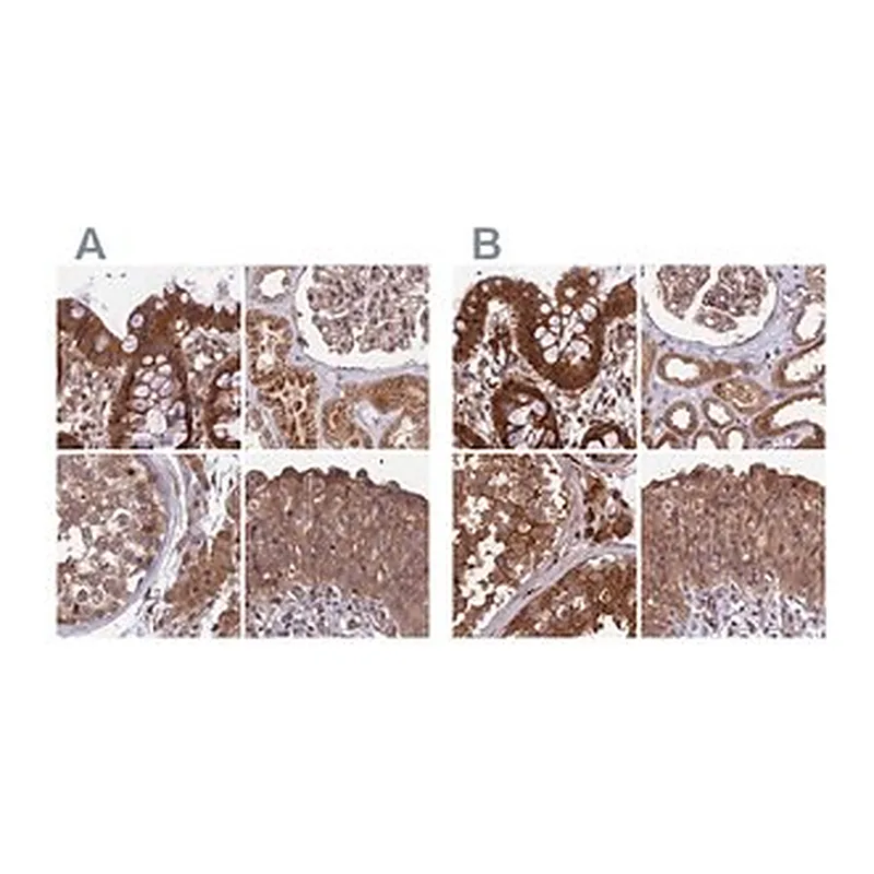 Merck Anti-MKKS antibody produced in rabbit