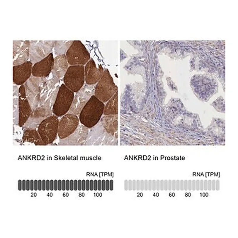 Merck Anti-ANKRD2 antibody produced in rabbit