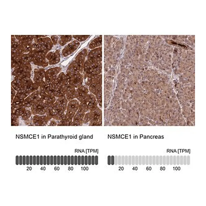 Merck Anti-NSMCE1 antibody produced in rabbit