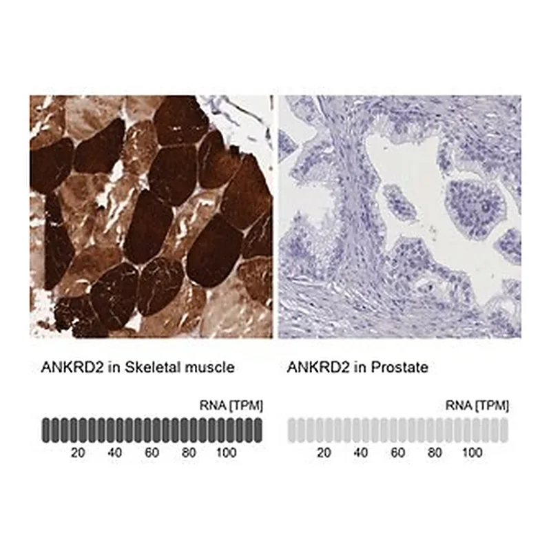Merck Anti-ANKRD2 antibody produced in rabbit