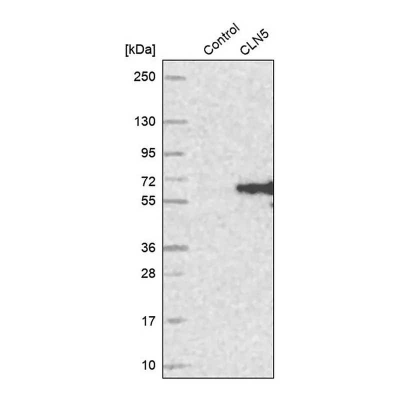 Merck Anti-CLN5 antibody produced in rabbit