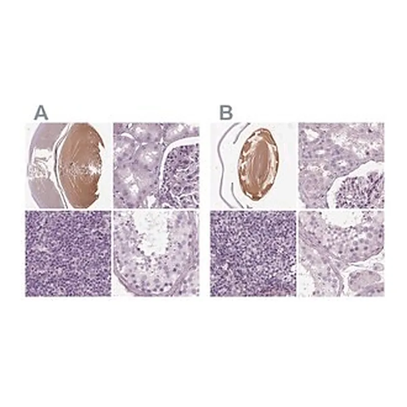 Merck Anti-BFSP1 antibody produced in rabbit