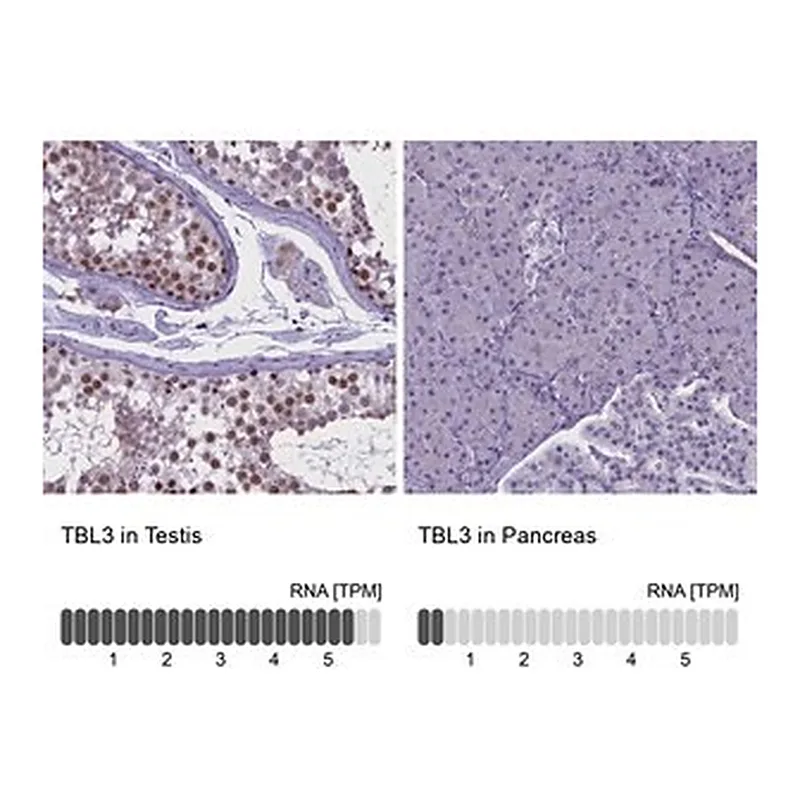 Merck Anti-TBL3 antibody produced in rabbit