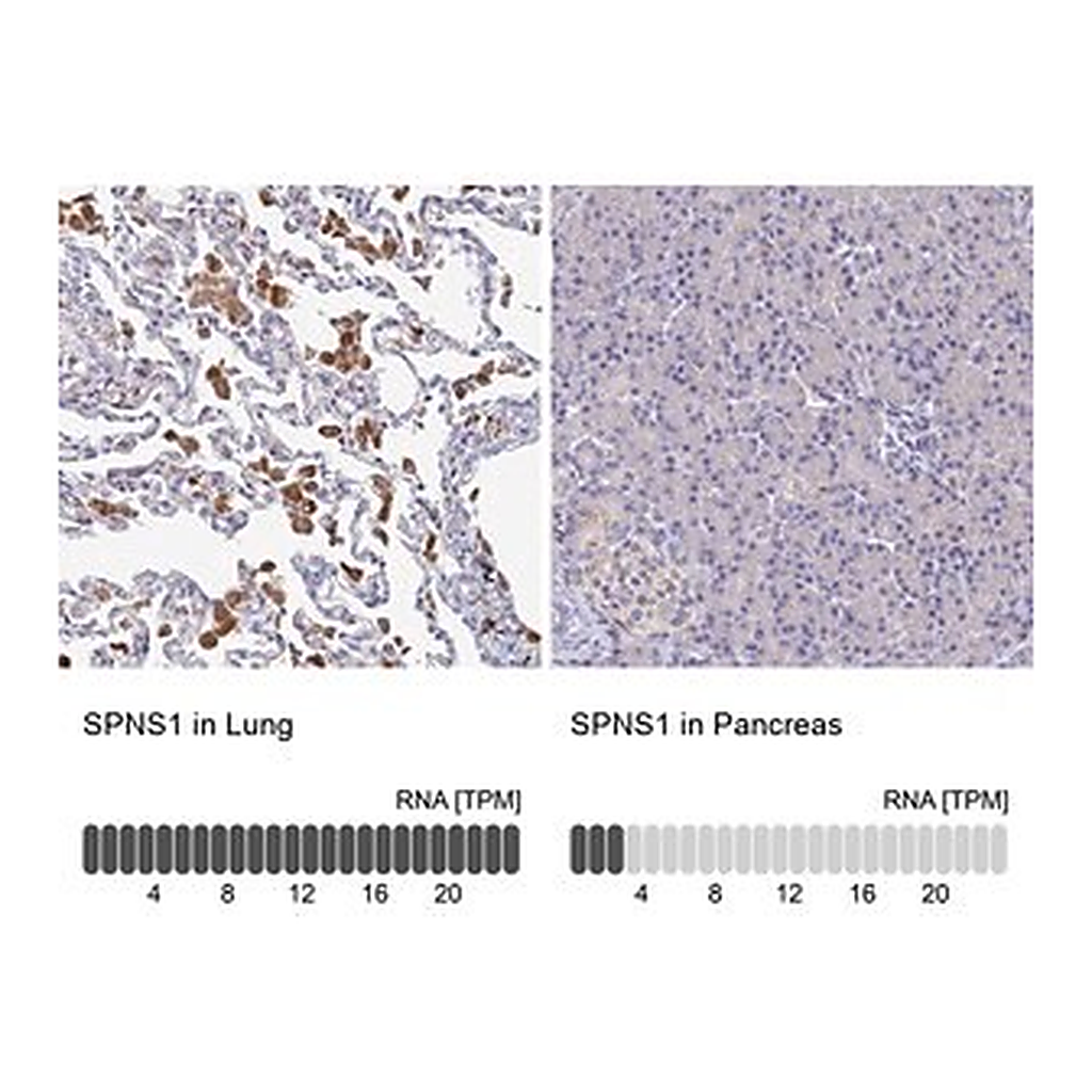 Merck Anti-SPNS1 antibody produced in rabbit | 캐시바이