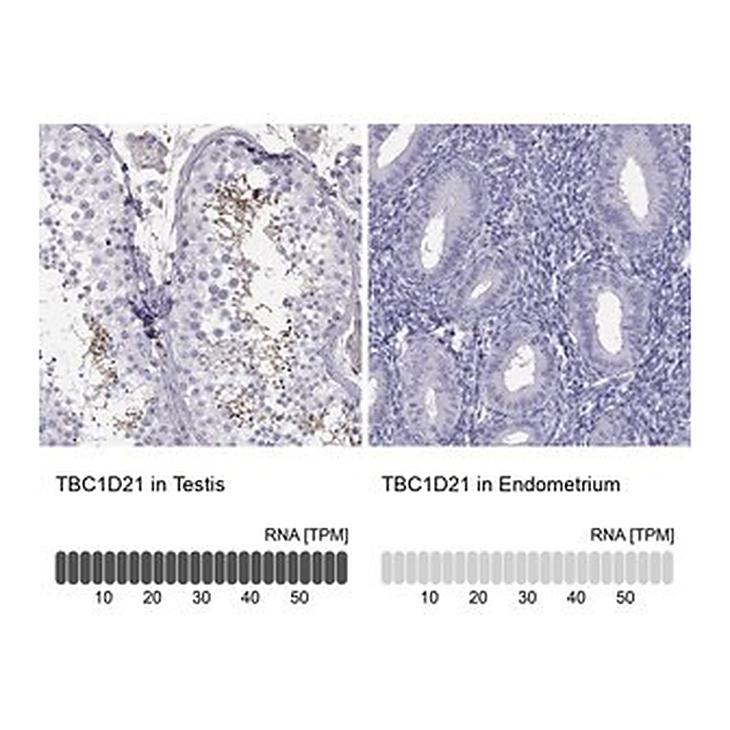 Merck Anti-TBC1D21 antibody produced in rabbit