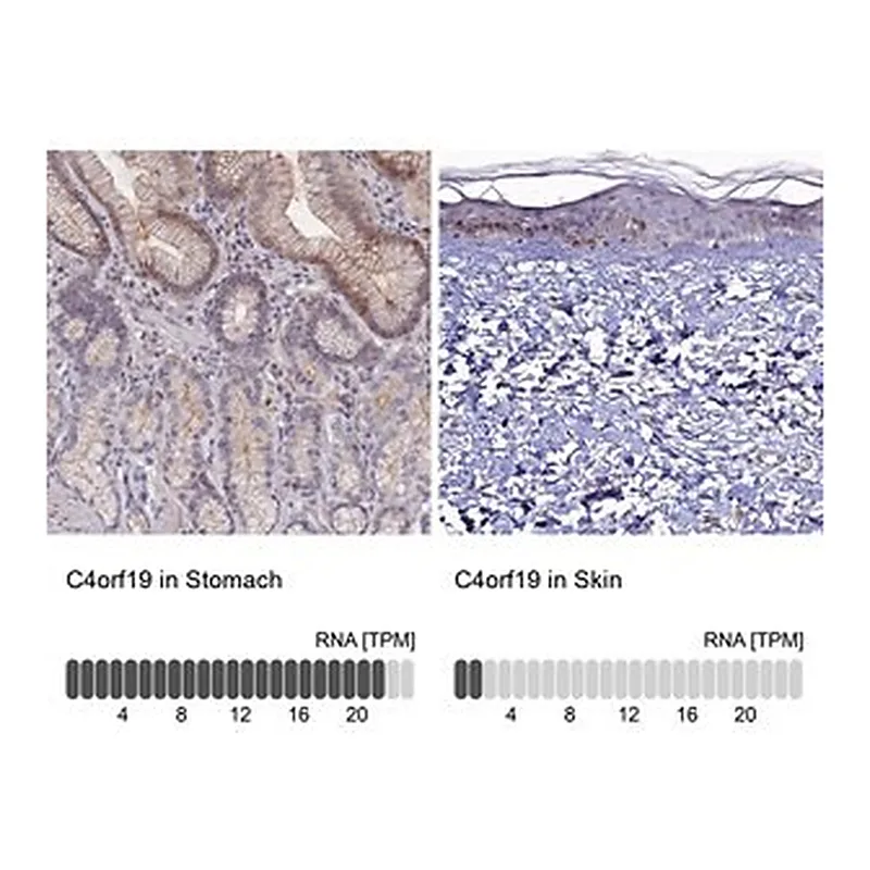 Merck Anti-C4orf19 antibody produced in rabbit
