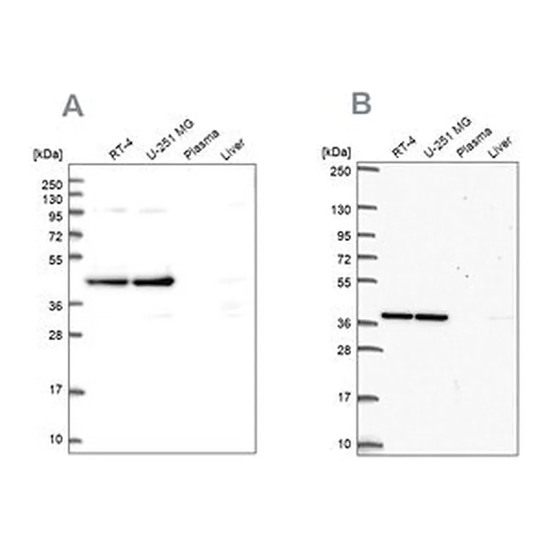 Merck Anti-CCDC94 antibody produced in rabbit