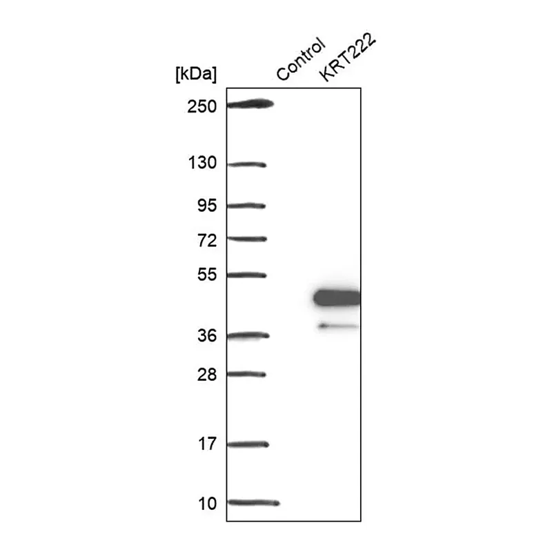 Merck Anti-KRT222 antibody produced in rabbit