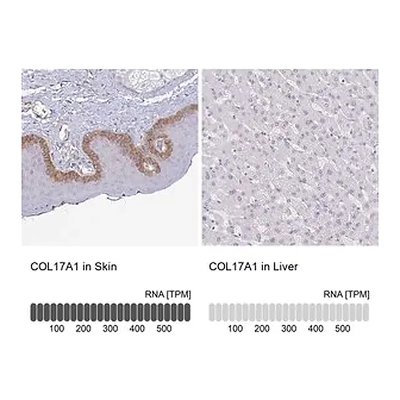 Merck Anti-COL17A1 antibody produced in rabbit
