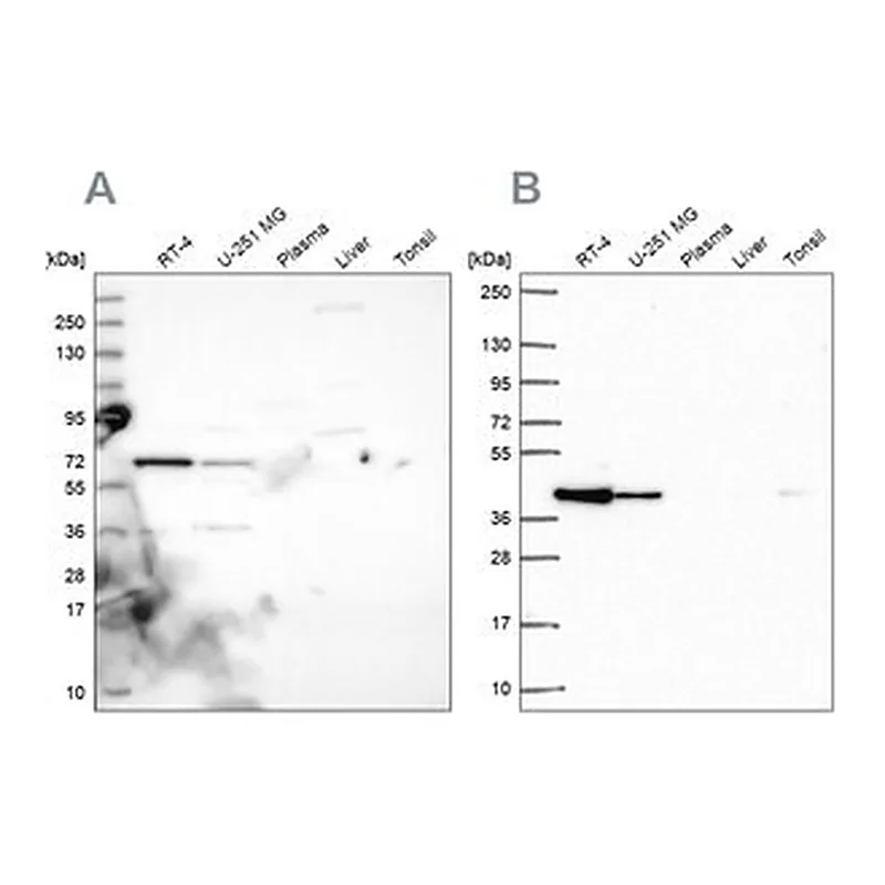 Merck Anti-GIPC1 antibody produced in rabbit