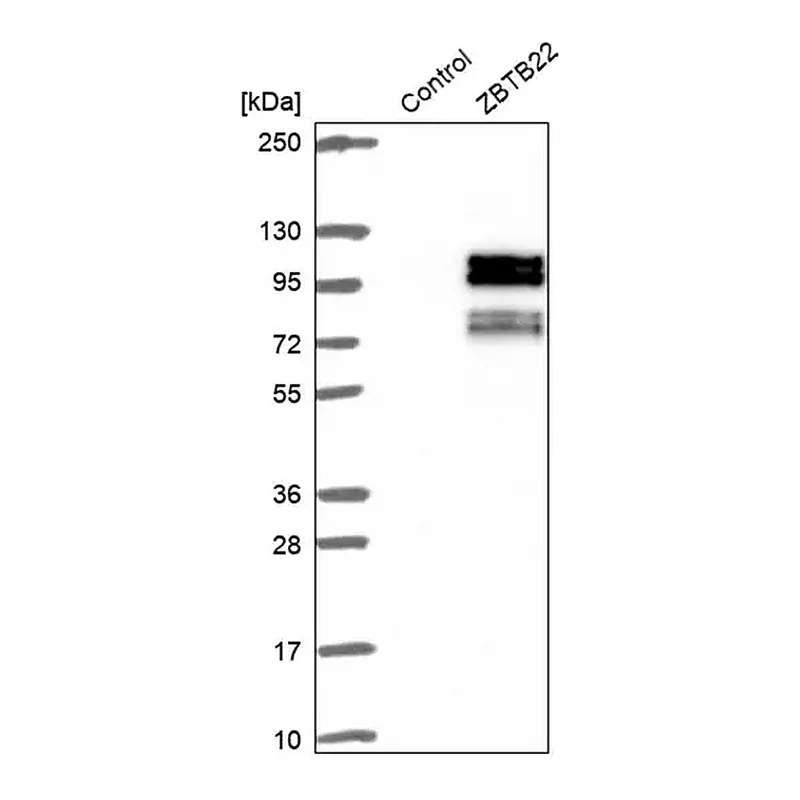 Merck Anti-ZBTB22 antibody produced in rabbit