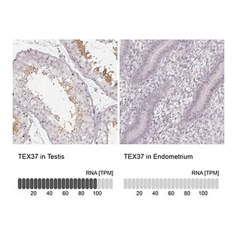 Merck Anti-TEX37 antibody produced in rabbit