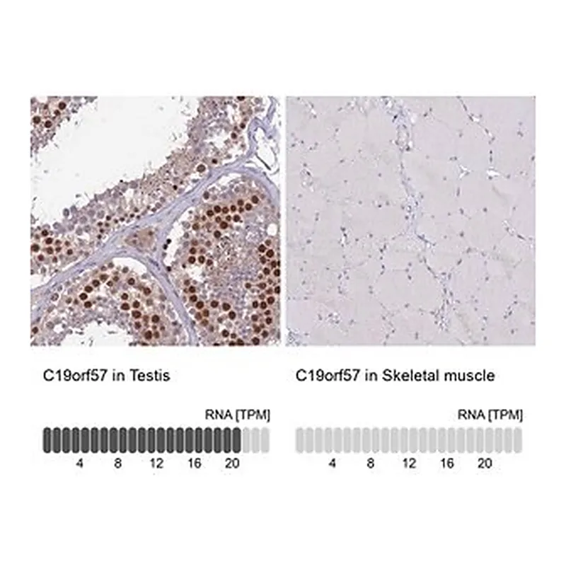 Merck Anti-C19orf57 antibody produced in rabbit