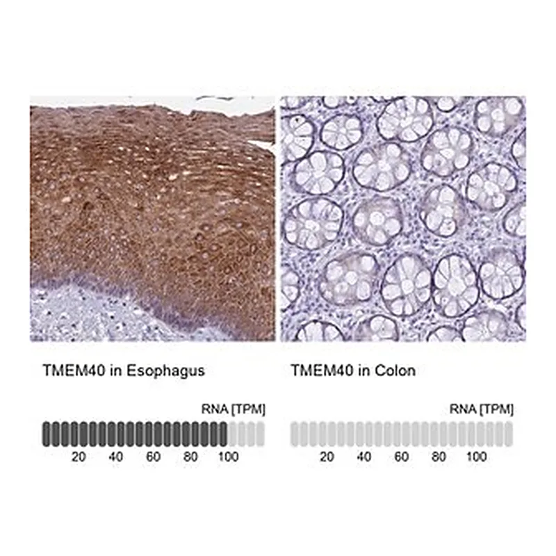 Merck Anti-TMEM40 antibody produced in rabbit