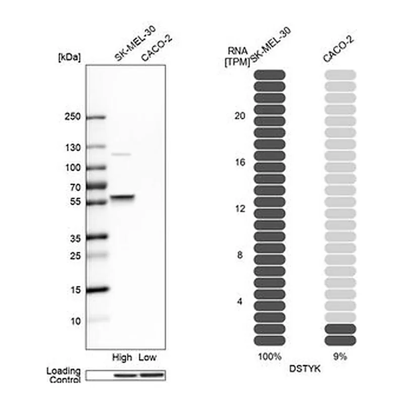 Merck Anti-DSTYK antibody produced in rabbit