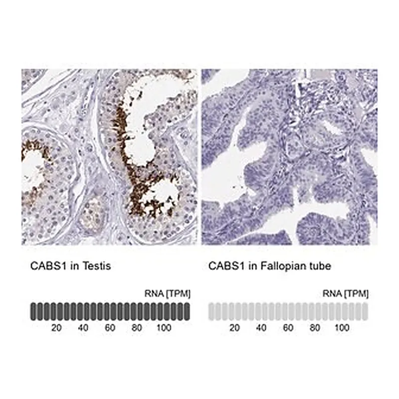 Merck Anti-CABS1 antibody produced in rabbit
