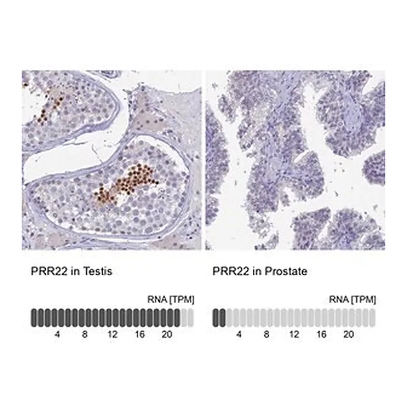 Merck Anti-PRR22 antibody produced in rabbit