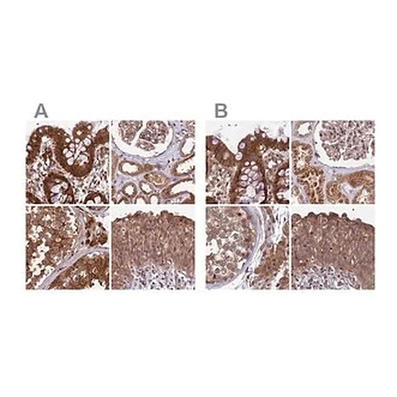 Merck Anti-MKKS antibody produced in rabbit