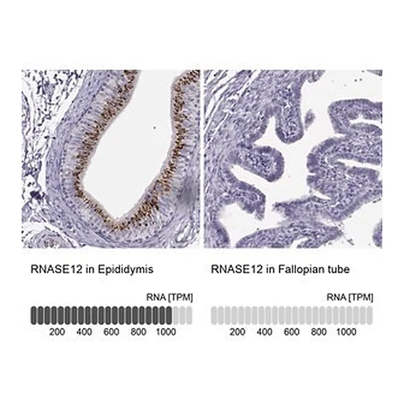Merck Anti-RNASE12 antibody produced in rabbit