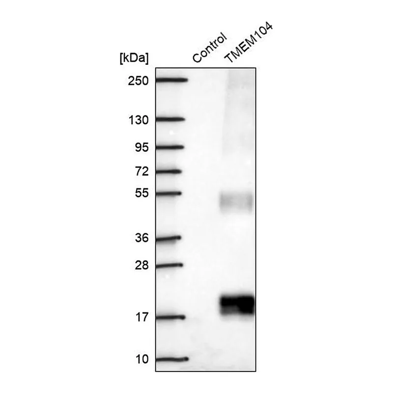 Merck Anti-TMEM104 antibody produced in rabbit