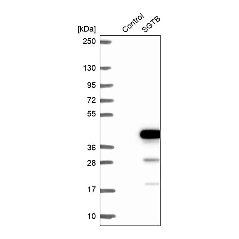 Merck Anti-SGTB antibody produced in rabbit