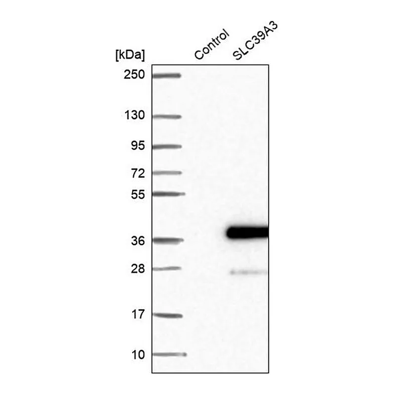 Merck Anti-SLC39A3 antibody produced in rabbit