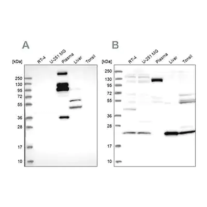 Merck Anti-REXO1 antibody produced in rabbit