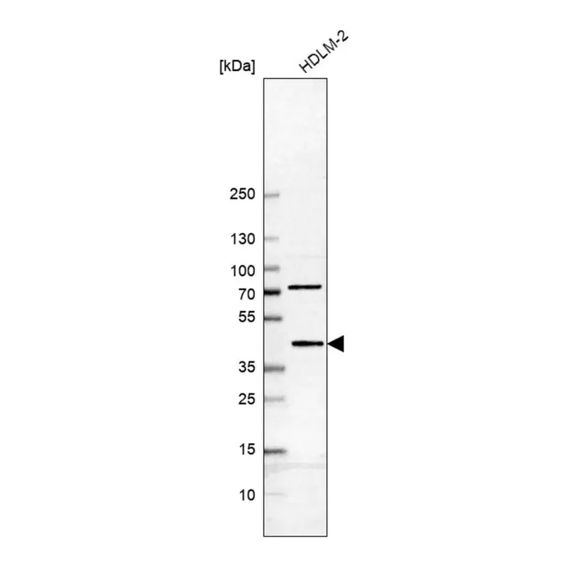 Merck Anti-B4GALT7 antibody produced in rabbit